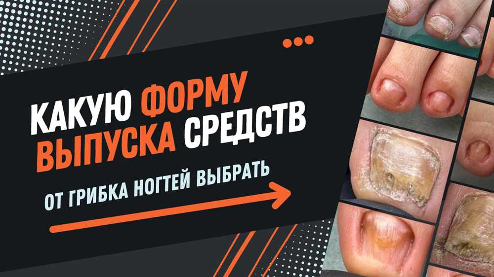 7 Эффективных Средств от Грибка Ногтей: Какое Выбрать и Как Применять