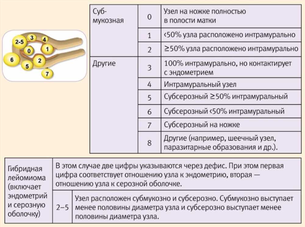 Миома матки: опасности заболевания и способы лечения