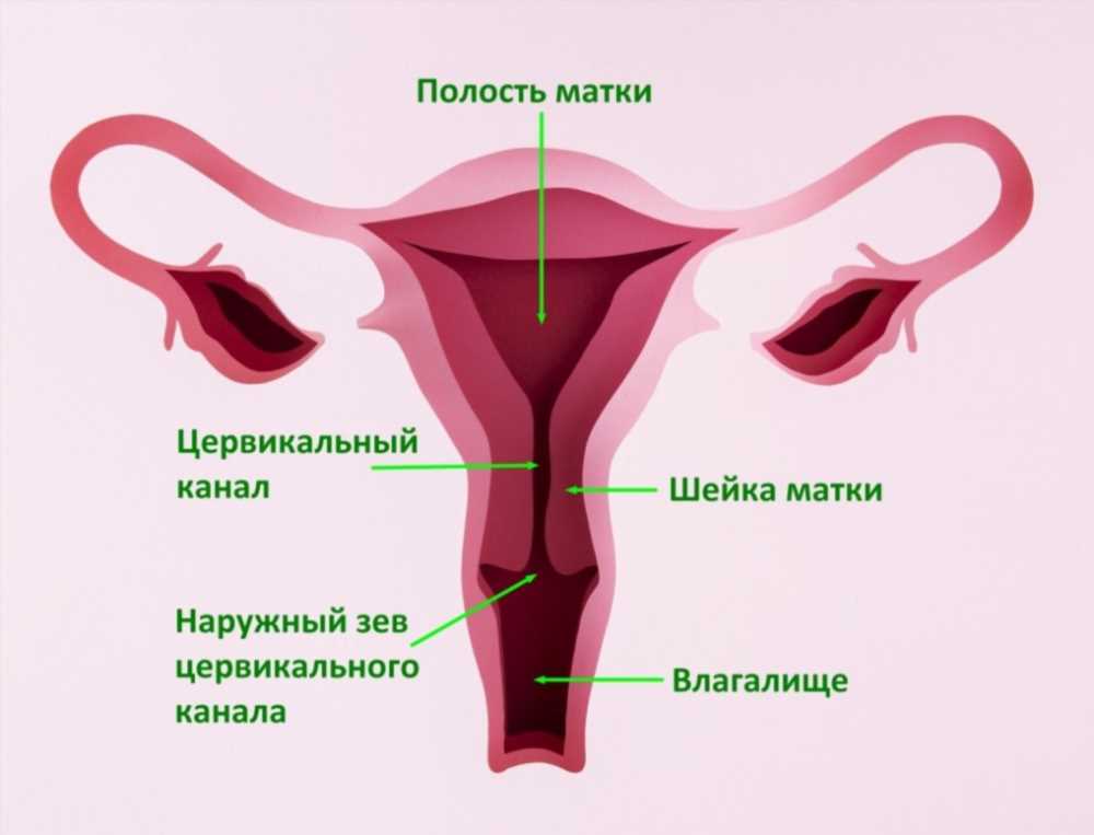 Народные методы лечения лейкоплакии шейки матки: эффективные средства и рекомендации