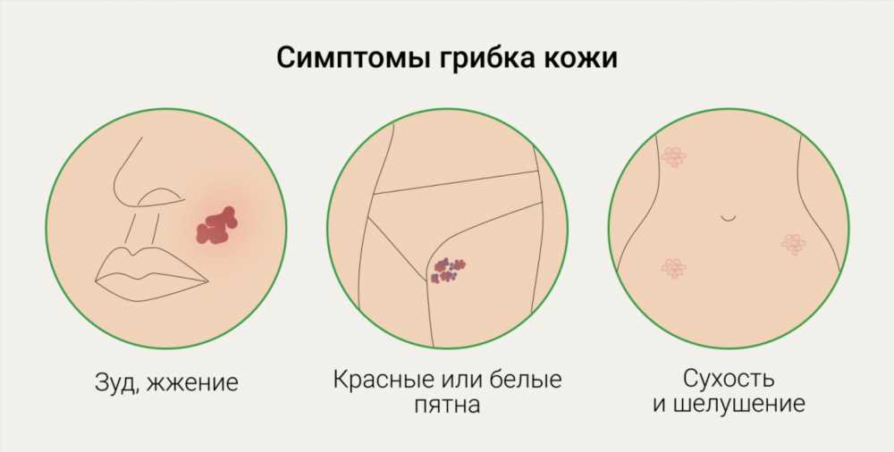 Почему возникает зуд при различных заболеваниях: понимание причин и способы облегчения