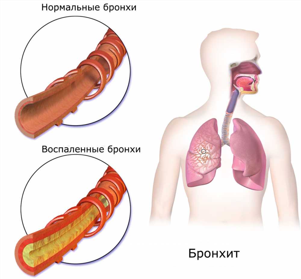 Понимание болей в груди: причины, симптомы и лечение