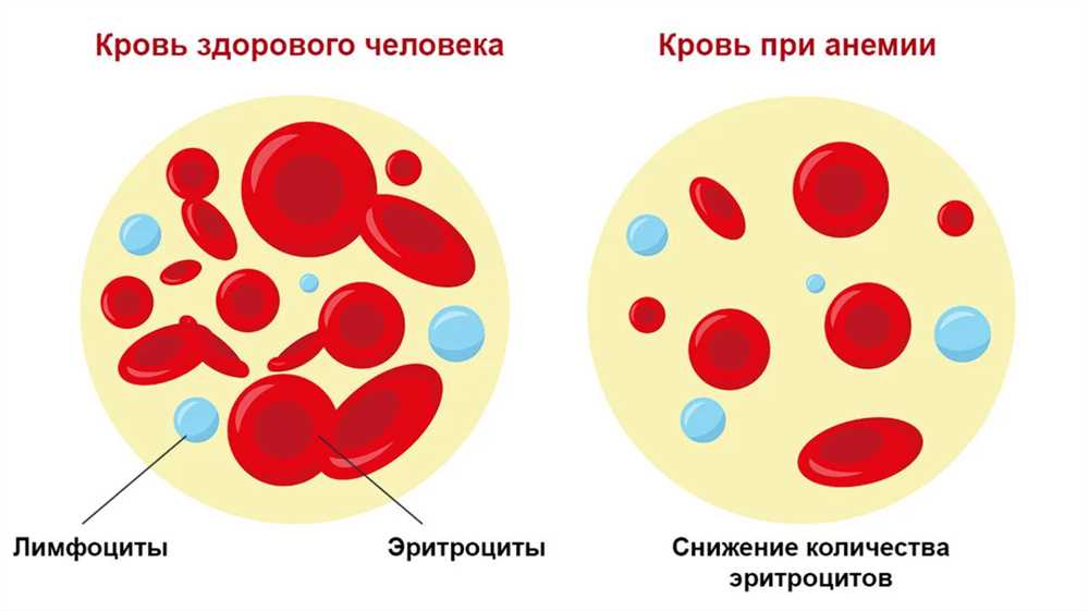 Понимание естественных причин белой рвоты: что стоит знать