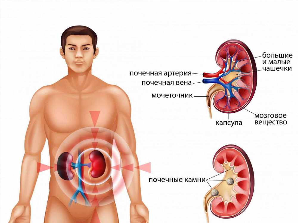 Понимание и предотвращение передозировки кальция: симптомы, последствия и меры предосторожности