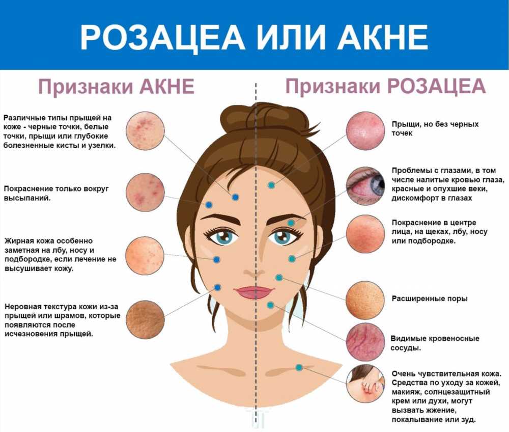 Причины и лечение коричневых выделений у женщин: основные факторы и методы борьбы