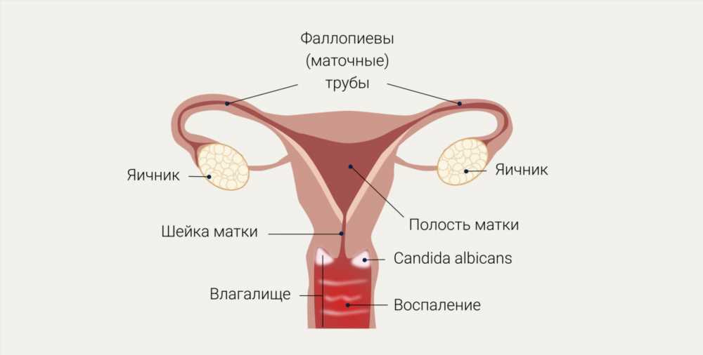 Причины и методы лечения опухших и чешущихся половых губ: Руководство для самостоятельного изучения