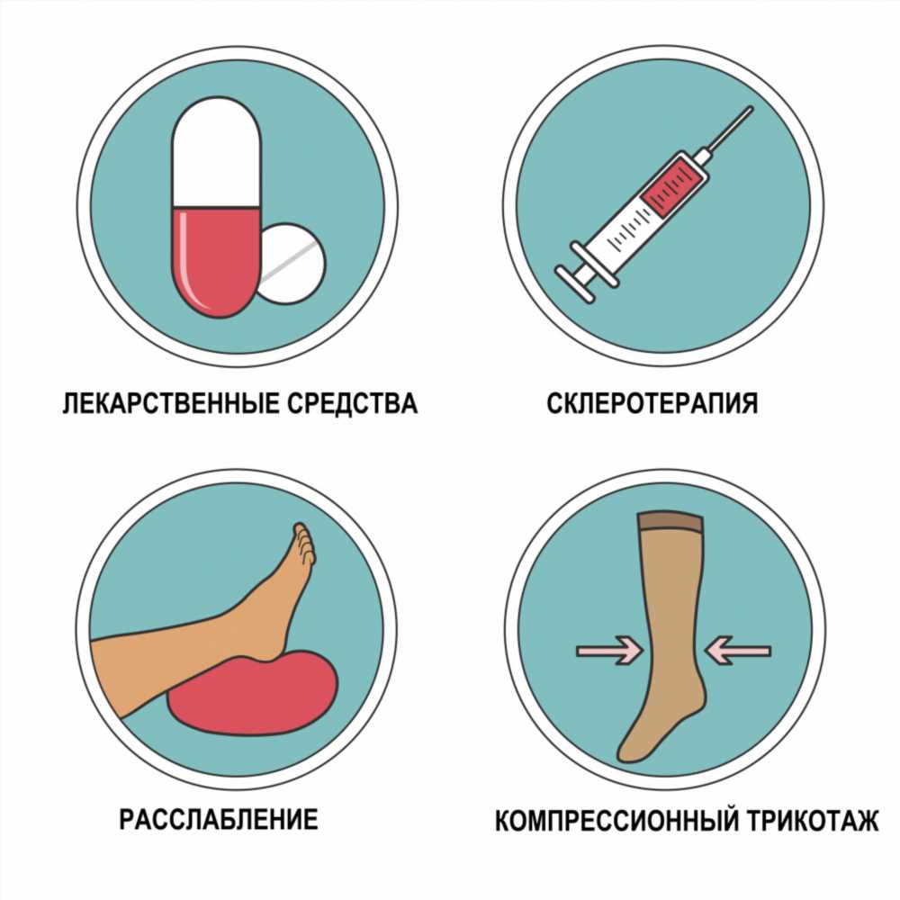 Тромбофлебит: причины, лечение и профилактика тромбоза вен