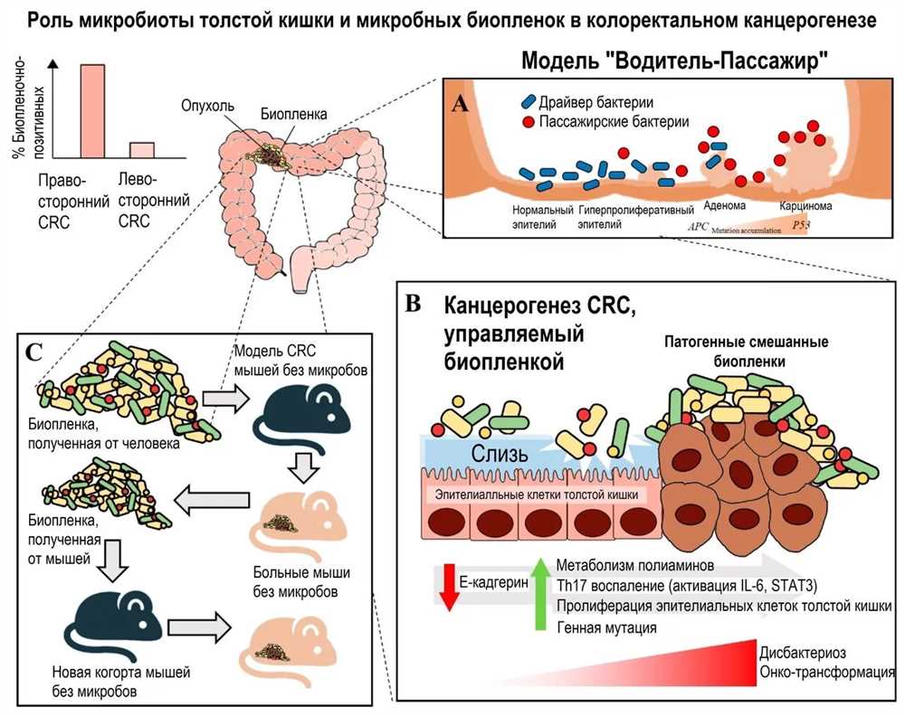 Влияние стафилококка на организм: механизмы действия и методы борьбы