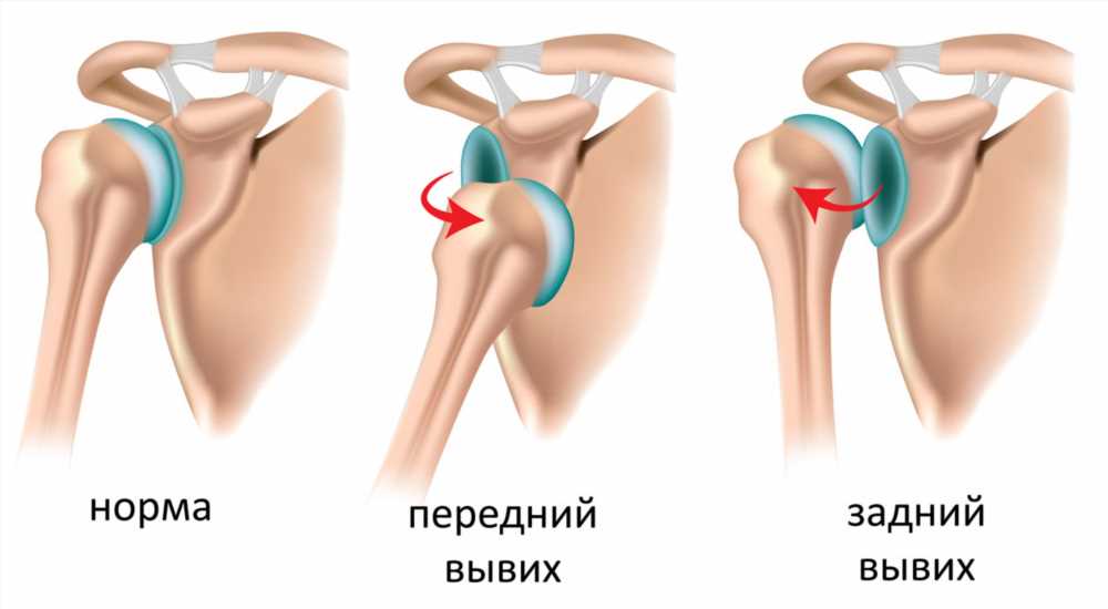 Все, что нужно знать о переломах костей у детей: причины, симптомы и методы лечения